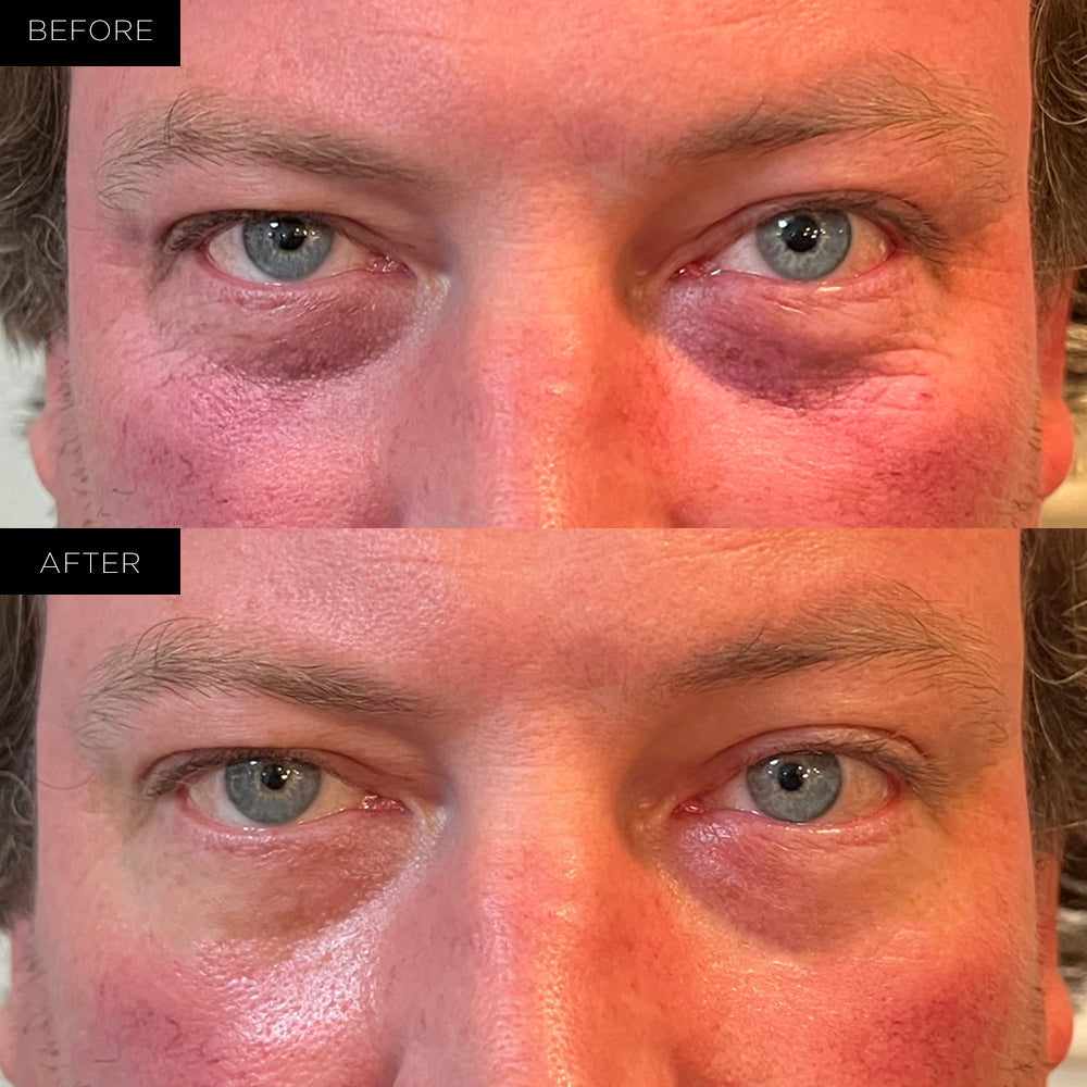 Endure™ Beauty Organiske Under Eye Therapy Gel Pads