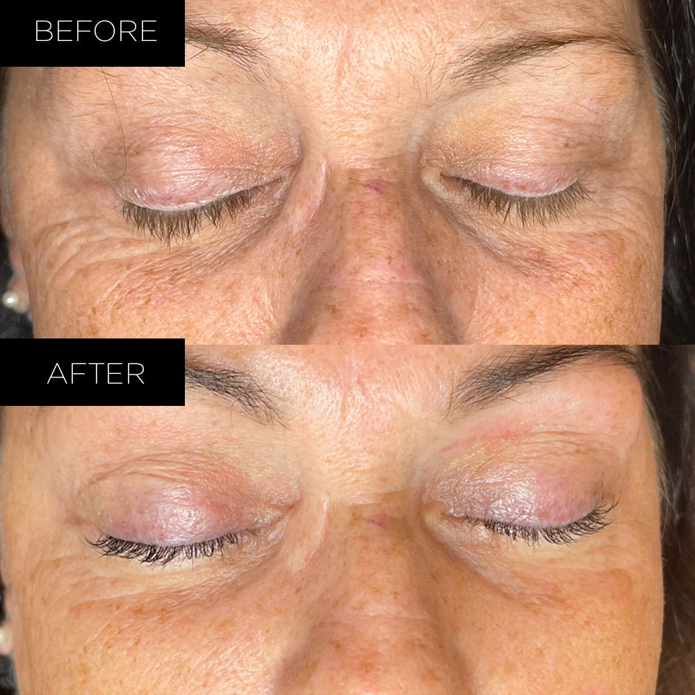Endure™ Beauty Organiske Under Eye Therapy Gel Pads