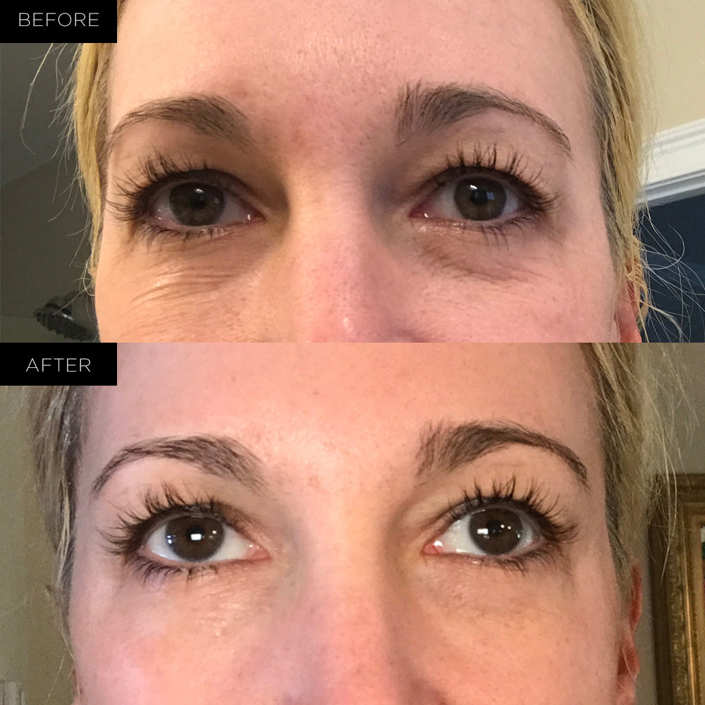 Endure™ Beauty Organiske Under Eye Therapy Gel Pads